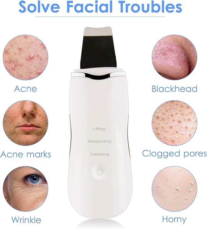 3-in-1 Ultrasonic Facial Skin Scrubber Removes blackheads, dead skin, and dirt