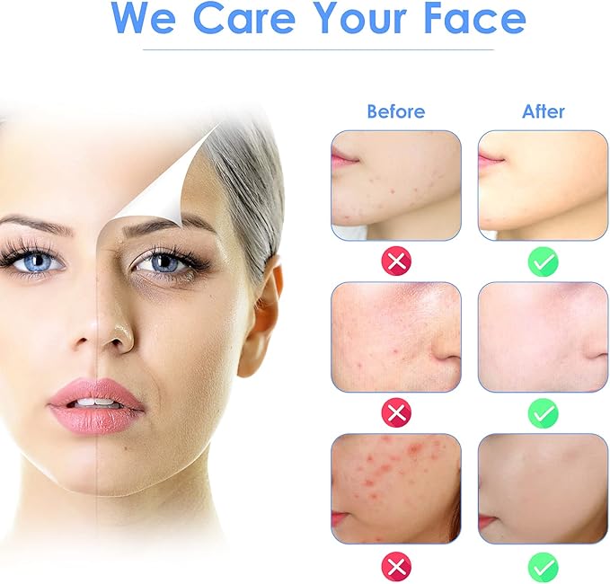 3-in-1 Ultrasonic Facial Skin Scrubber Removes blackheads, dead skin, and dirt