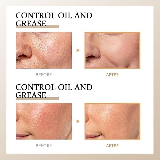 Moolinse Peel Shot P5 Exfoliant Ampoule Face Korean Skin Care (Pack of 2)