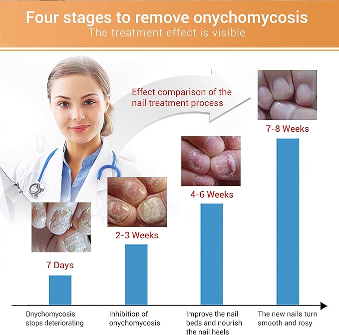 مستحضر لانبينا لإصلاح الأظافر التالفة