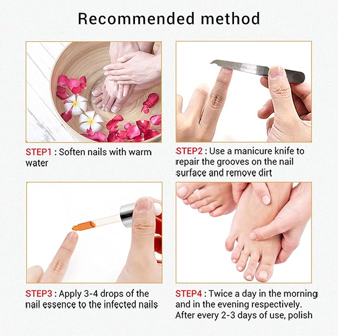 مستحضر لانبينا لإصلاح الأظافر التالفة