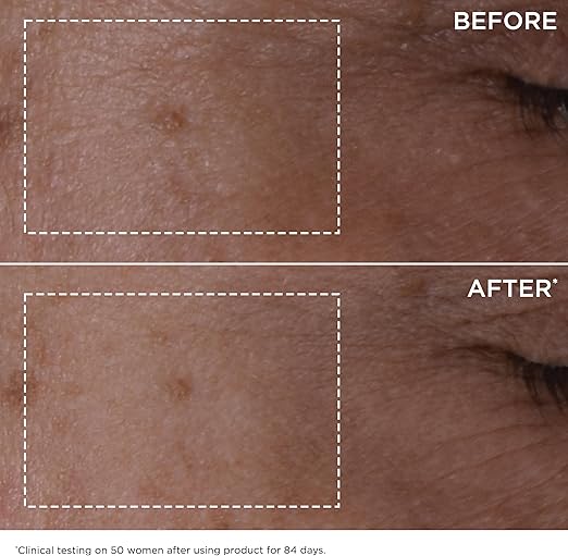 Clarins Paris - Age-Defying Double Serum (Original) ©100ml