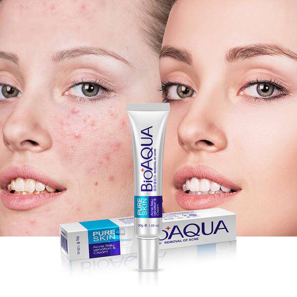 BIOAQUA - Acne Removing and Rejuvenating Cream