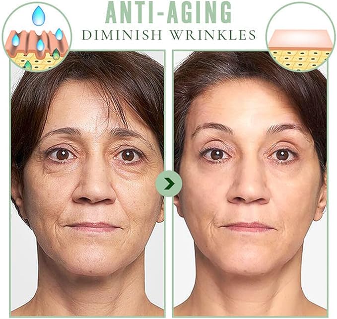 قناع شد البشرة بالكولاجين من إيلهو - عبوة من 20 قناع شد البشرة بالكولاجين الكوري (أصلي)