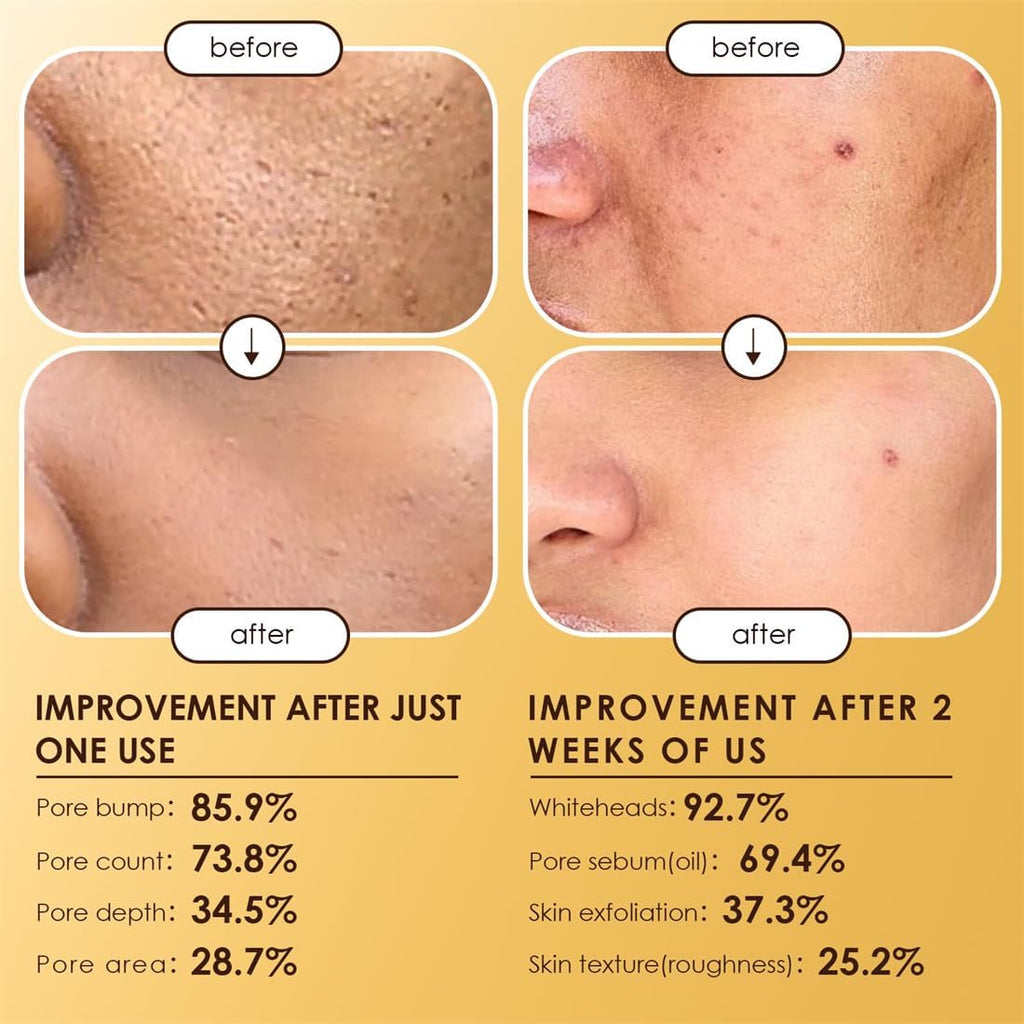 Moolinse Peel Shot P5 Exfoliant Ampoule Face Korean Skin Care (Pack of 2)