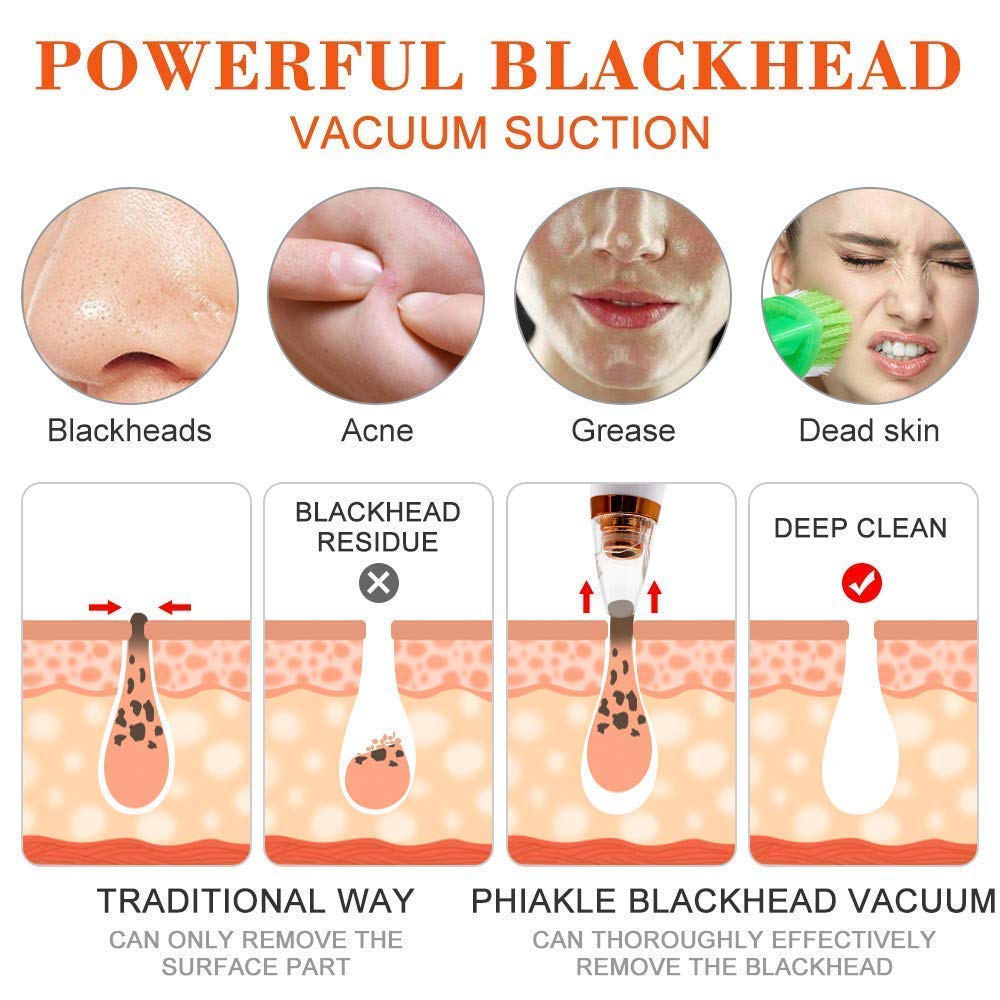 Multi-Functional Cleaning Remove Blackhead Device 6 Suction Heads