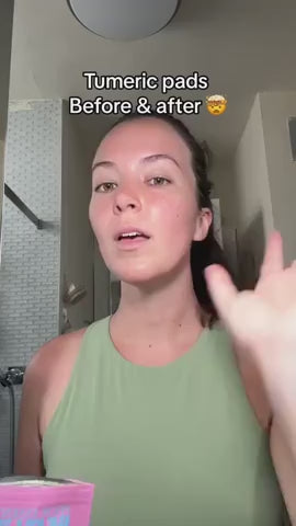 مناديل تنظيف حمض الكوجيك بالكركم - عبوة من 40 قطعة