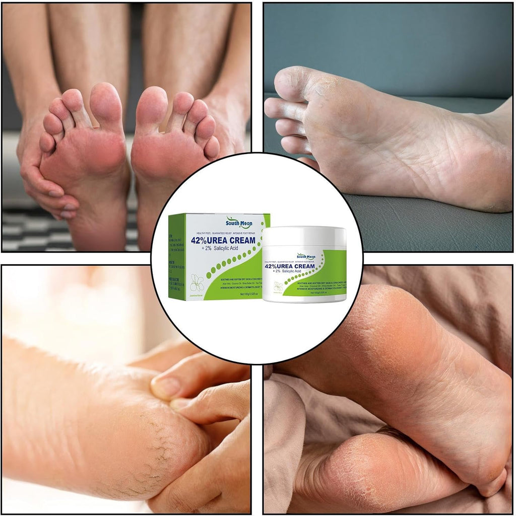 ساوث مون - كريم اليوريا 42% + حمض الساليسيليك 2% (الأصلي)